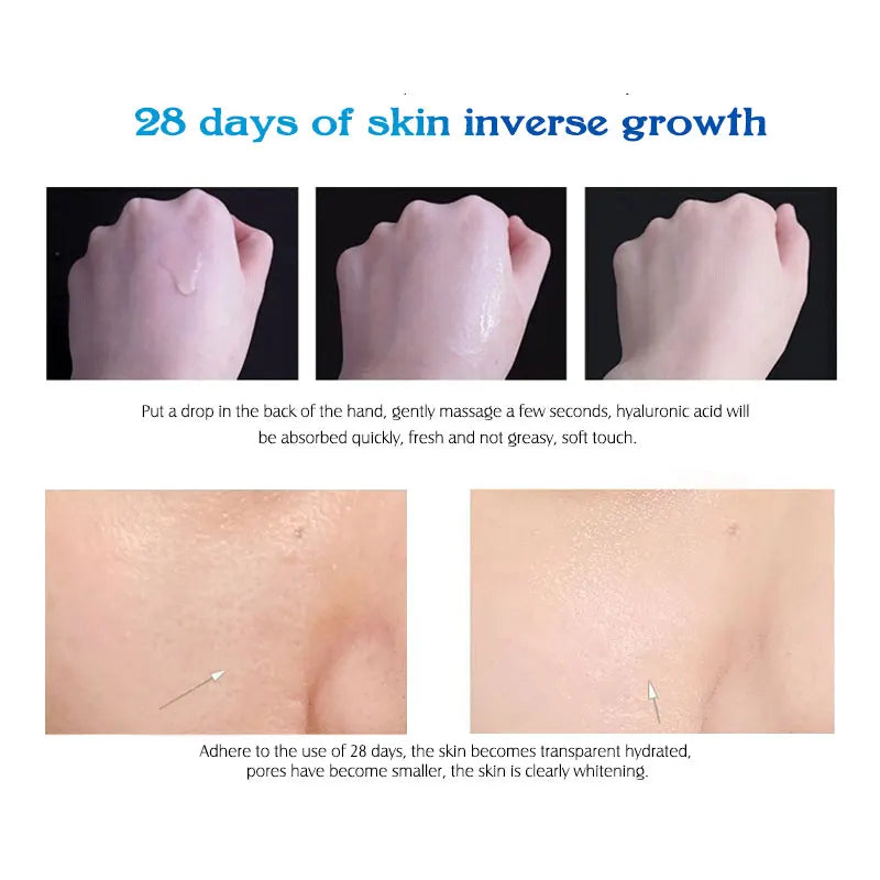 ARTISCARE Hyaluronic Acid Serum VC Essence Face Cream Moisturizing Acne Aging & Wrinkles Repair 10PCS