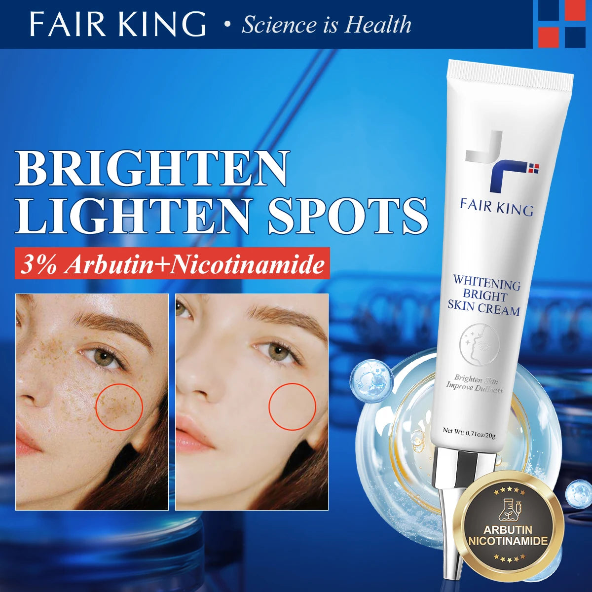 Fair King Brighten Lighten Spots Cream | Dark Spot Remover - 3% Arbutin + Nicotinamide - Fade Age Spots