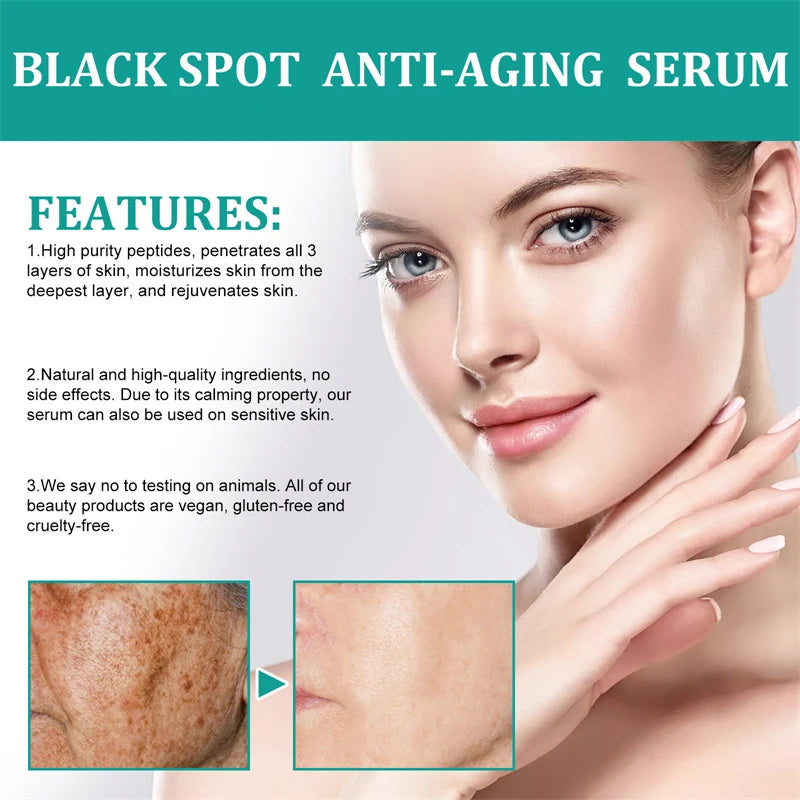 Stubborn Spot Remover Serum | Anti-Pigmentation Fade Melasma Clear Blemishes - 7 Day Challenge Results