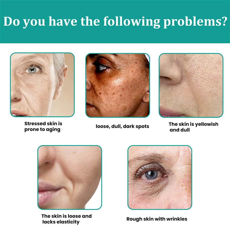 Stubborn Spot Remover Serum | Anti-Pigmentation Fade Melasma Clear Blemishes - 7 Day Challenge Results