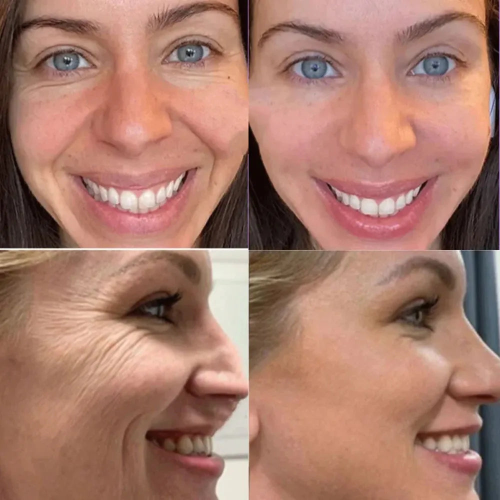 Botox-in-a-Bottle Retinol-Serum