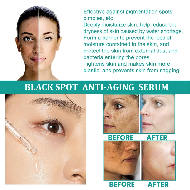 Stubborn Spot Remover Serum | Anti-Pigmentation Fade Melasma Clear Blemishes - 7 Day Challenge Results