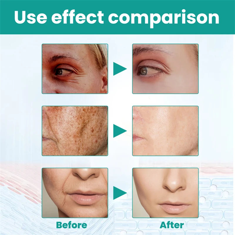 Stubborn Spot Remover Serum | Anti-Pigmentation Fade Melasma Clear Blemishes - 7 Day Challenge Results