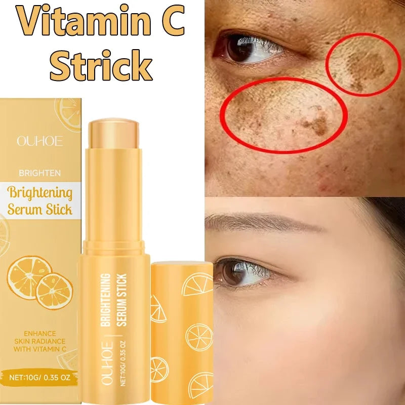 Vitamin C Whitening Freckles Serum Stick Remove Melasma Dark Spots Corrector Lighten Melanin Acne Anti-Aging Brighten Skin Care