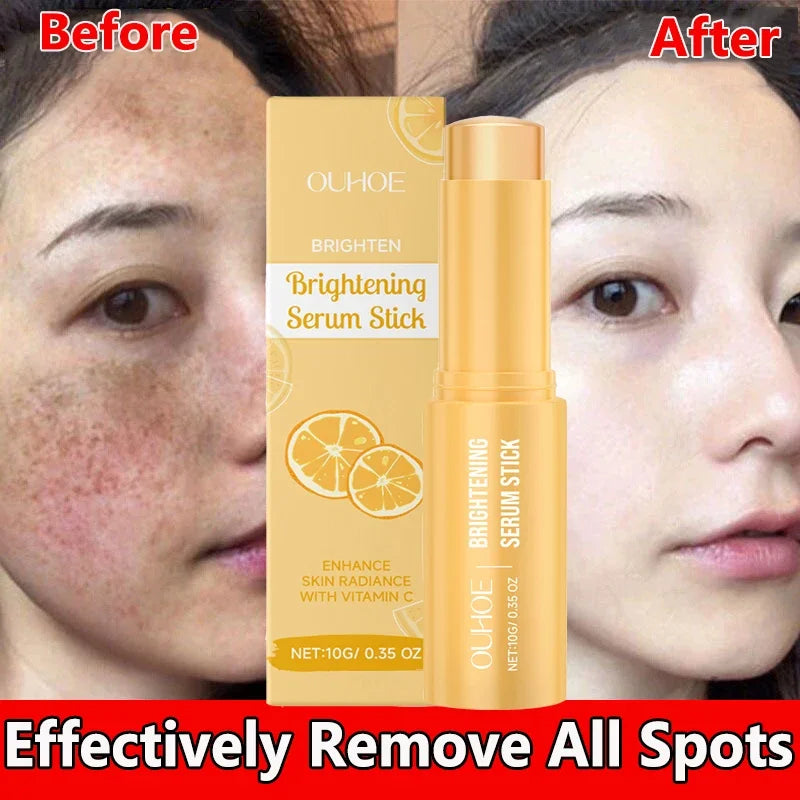 Vitamin C Whitening Freckles Serum Stick Remove Melasma Dark Spots Corrector Lighten Melanin Acne Anti-Aging Brighten Skin Care