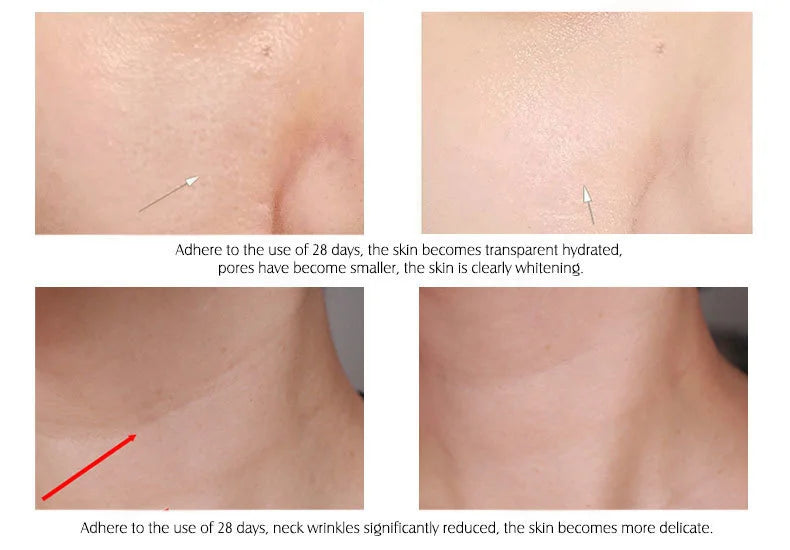 ARTISCARE Hyaluronic Acid Serum VC Essence Face Cream Moisturizing Acne Aging & Wrinkles Repair 10PCS