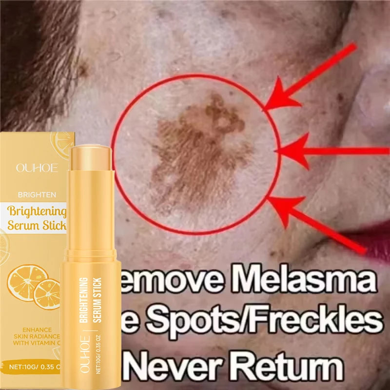 Vitamin C Whitening Freckles Serum Stick Remove Melasma Dark Spots Corrector Lighten Melanin Acne Anti-Aging Brighten Skin Care
