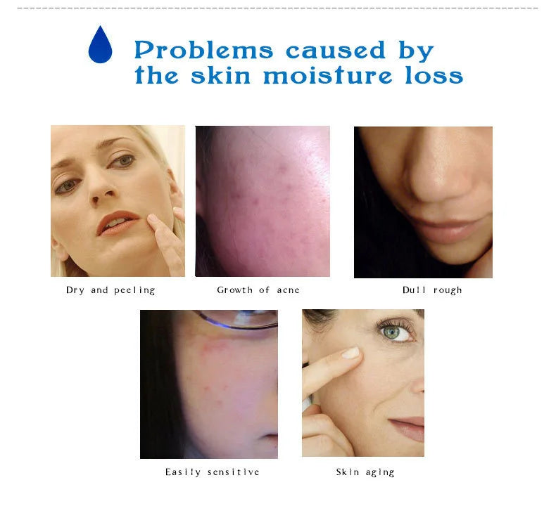 ARTISCARE Hyaluronic Acid Serum VC Essence Face Cream Moisturizing Acne Aging & Wrinkles Repair 10PCS