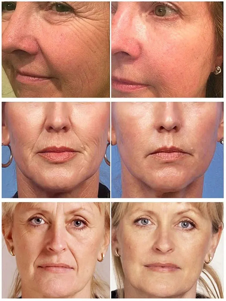 Botox-in-a-Bottle Retinol-Serum